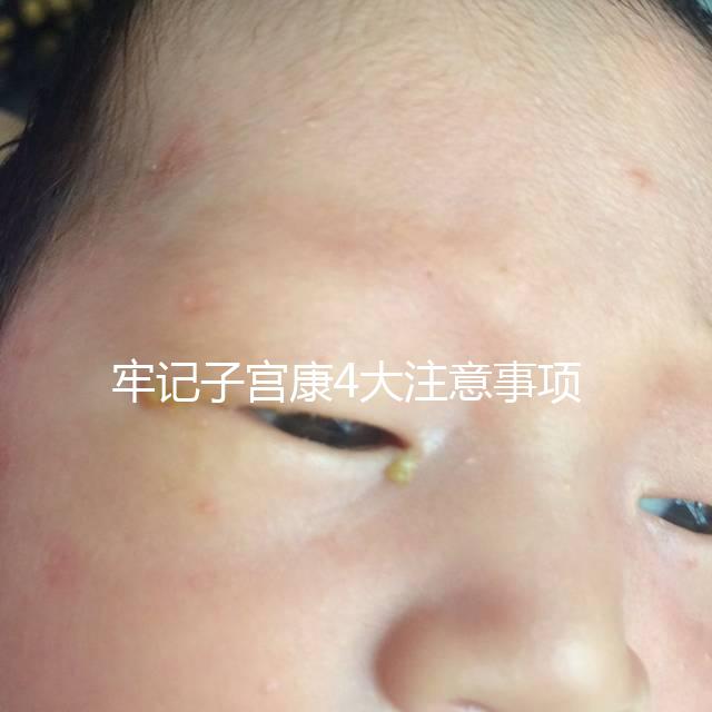 牢記子宮康4大注意事項(xiàng)，輕松避免胃脹、腹瀉等副作用