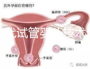 第一代試管嬰兒技術(shù)全解析：流程、適應(yīng)癥及優(yōu)缺點(diǎn)指南