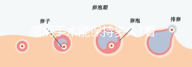 縮陰手術能保持多久?看看做過的人怎么說