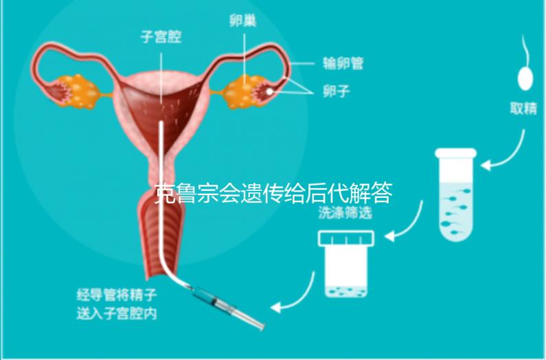 克魯宗會遺傳給后代解答嗎？他生來就有一篇清晰的文章嗎？