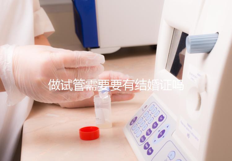 做試管需要要有結(jié)婚證嗎？做試管需要結(jié)婚證