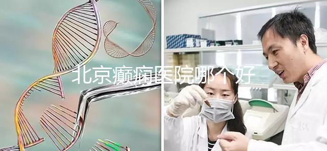 北京癲癇醫(yī)院哪個(gè)好