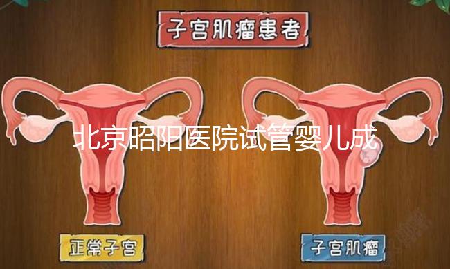 北京昭陽醫院試管嬰兒成功率？生殖醫院醫生排名推薦