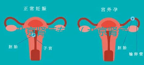 北京腎病專(zhuān)家（北京腎病專(zhuān)家前十名）