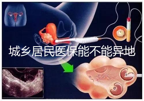 城鄉(xiāng)居民醫(yī)保能不能異地試管報(bào)銷(xiāo)？詳解2025試管醫(yī)保異地報(bào)銷(xiāo)的流程