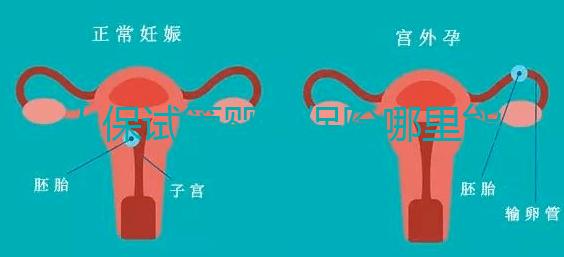 人保試管嬰兒保險哪里能買、怎么買速覽，一篇看懂不踩坑