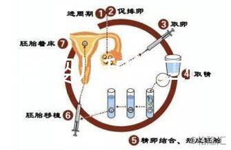 代試管嬰兒和第二代試管嬰兒的區別，基因篩查技術！