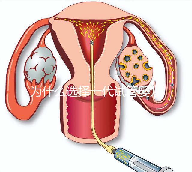 為什么選擇一代試管嬰兒？全面解析其獨特優勢與適用場景