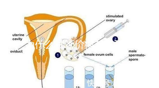 為什么試管價格差異那么大？做試管到底要花多少錢？