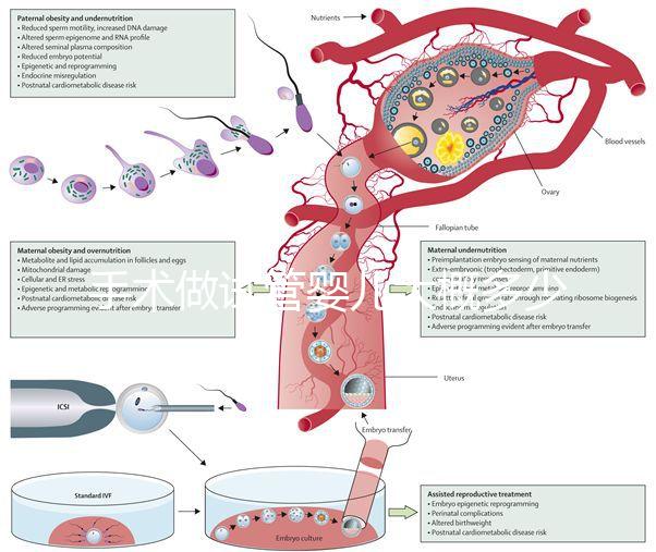 手術(shù)做試管嬰兒大概多少錢(qián)(手術(shù)做試管嬰兒大概多少錢(qián)啊)