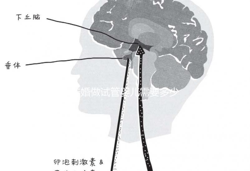 未婚做試管嬰兒需要多少錢？公立醫院費用大概在3-12萬