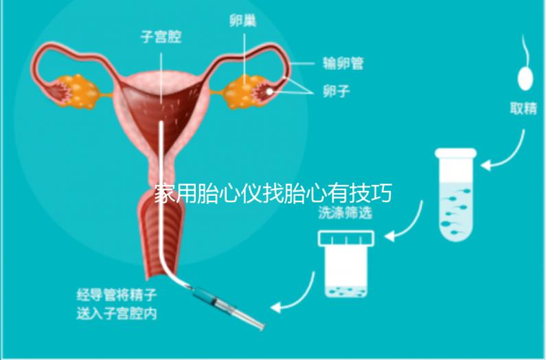 家用胎心儀找胎心有技巧，飯后半個(gè)小時(shí)測(cè)準(zhǔn)確率稍高