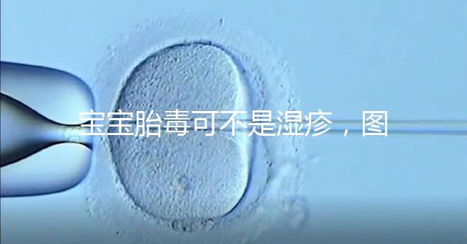 寶寶胎毒可不是濕疹，圖文解讀兩者詳細區別