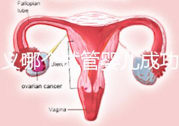 遵義哪個試管嬰兒成功率高？貴州生殖中心醫院2024年排名參考