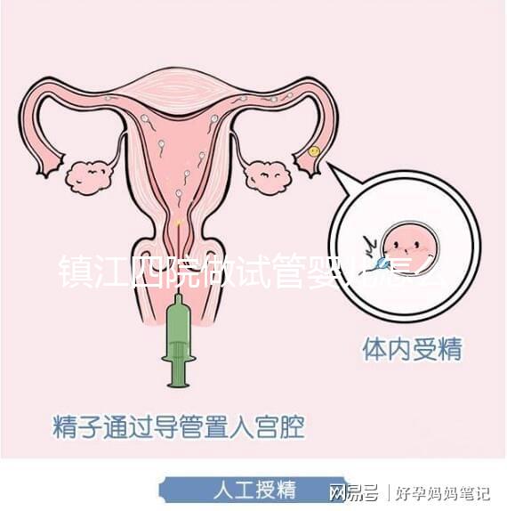 鎮江四院做試管嬰兒怎么樣？具體成功率費用介紹