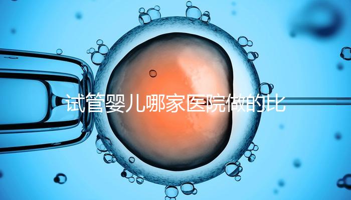 試管嬰兒哪家醫(yī)院做的比較好