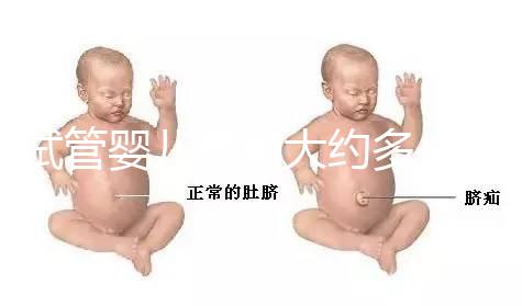 試管嬰兒費用大約多少2021（試管嬰兒費用大約多少2021年鄭州）