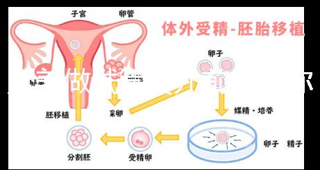 赴美做試管嬰兒前，教你如何攻破最難的“醫療簽證”！