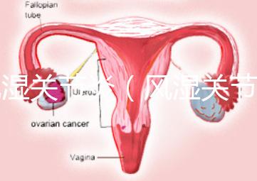 風(fēng)濕關(guān)節(jié)炎（風(fēng)濕關(guān)節(jié)炎的癥狀有哪些）