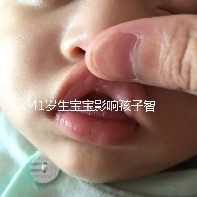 41歲生寶寶影響孩子智商嗎?從這3個方面來看影響不大