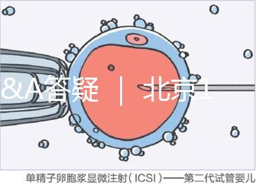 Q&A答疑 ｜ 北京16項輔助生殖技術進醫保，試管可以報銷嗎？