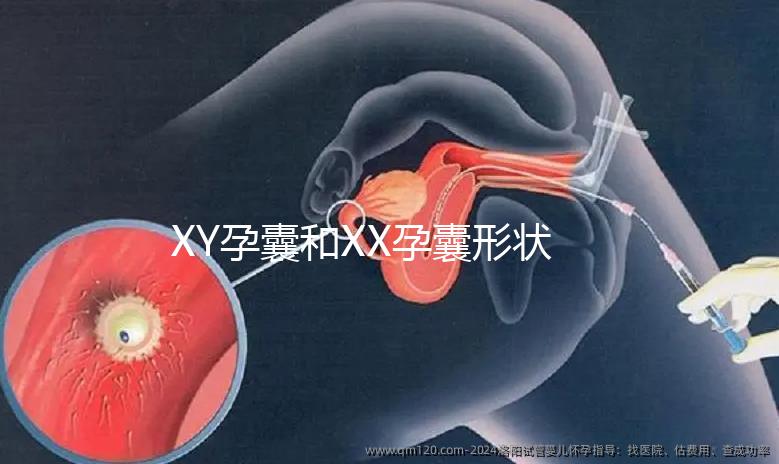 XY孕囊和XX孕囊形狀各有差異，橢圓形可能是懷女哦！