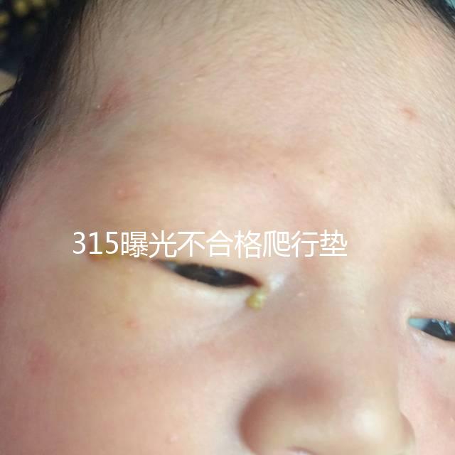 315曝光不合格爬行墊品牌，甲酰胺超標(biāo)的危害可不小