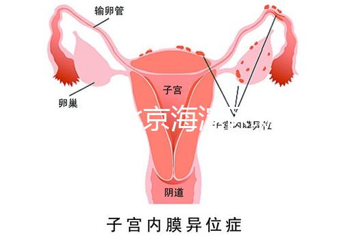 2024年北京海淀區新生兒醫療保險處理策略，照片要求不要出錯