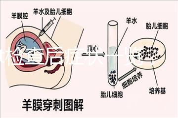 tct檢查后癥狀一覽，專家提醒做好處理措施是關鍵